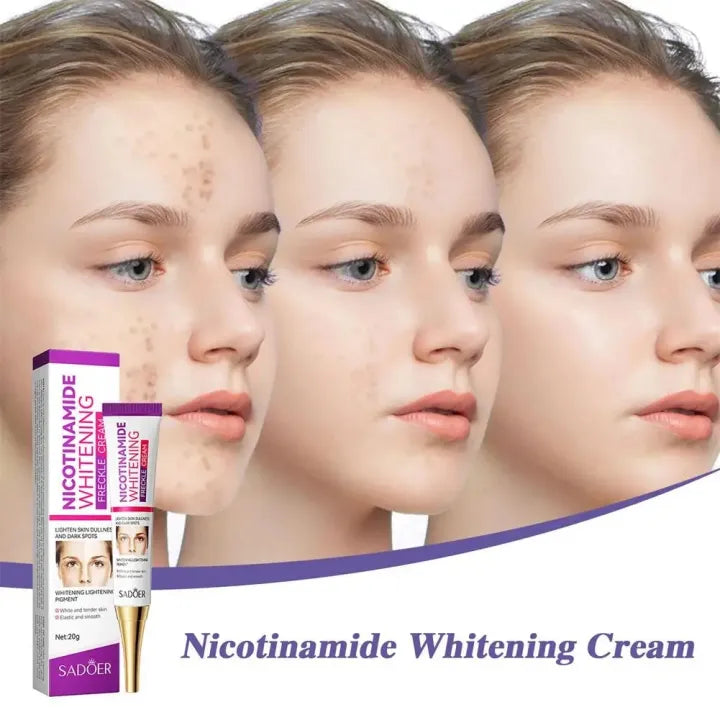 Nicotinamide Whitening Freckles Cream Remove Melasma Dark Spot Acne Marks Lightening Melanin