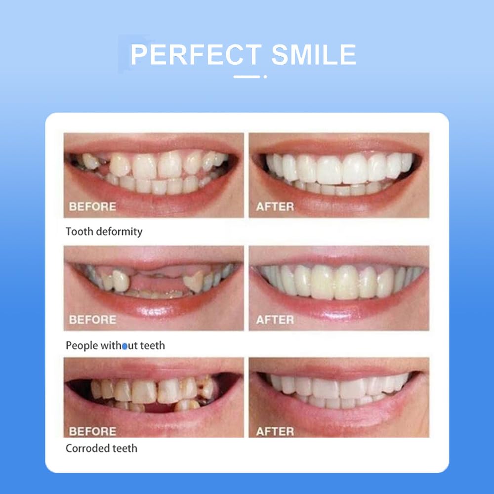 Snap-On smile for Beautiful Smiles Temporary Comfort Fit Whitening Instant Transformation for