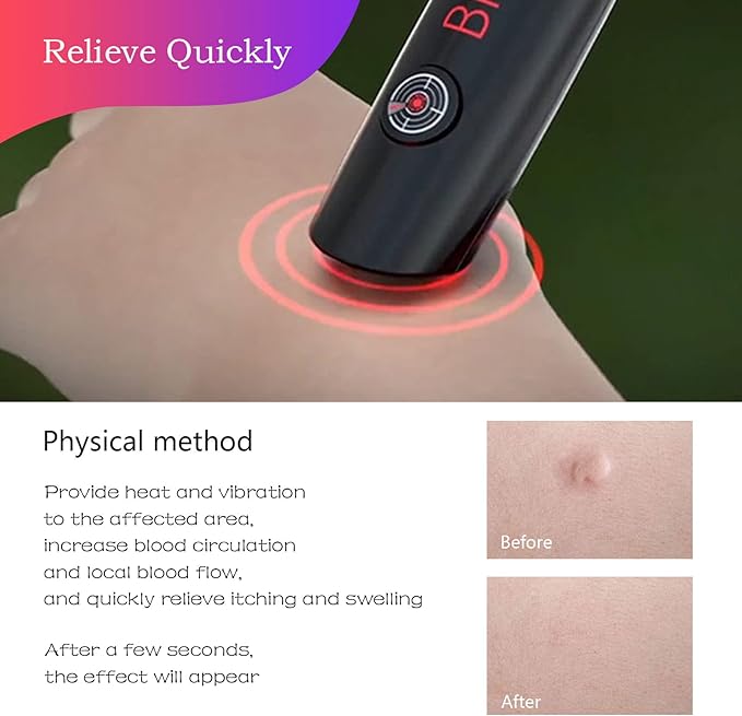 Mosquito Bite Helper - Insect Bite Relief, Useful for Summer, Helps Children,