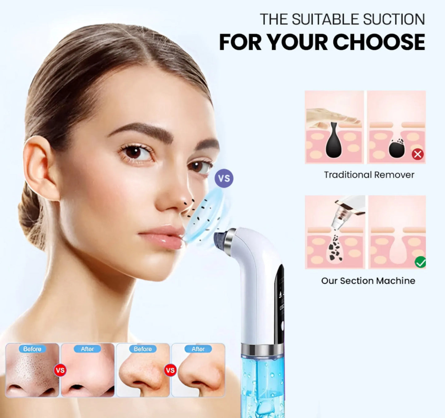 Bubble Facial & Blackhead Remover Deep Cleanser for Acne, Pores &