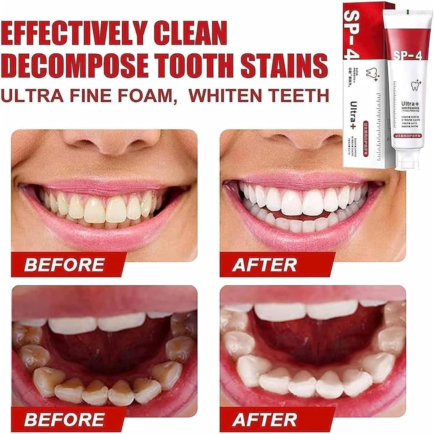 Yayashi Sp-4 Ultra Whitening Toothpaste Probiotic Stain Remover / Stain Removing