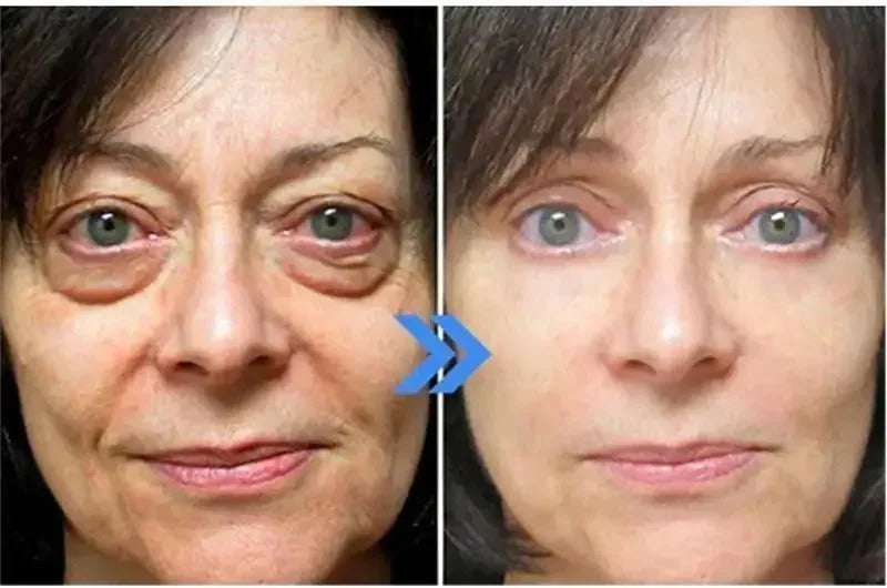 10pcs / 1 Box Eyes Bag Remove Collagen Eye Patch Instant Fade