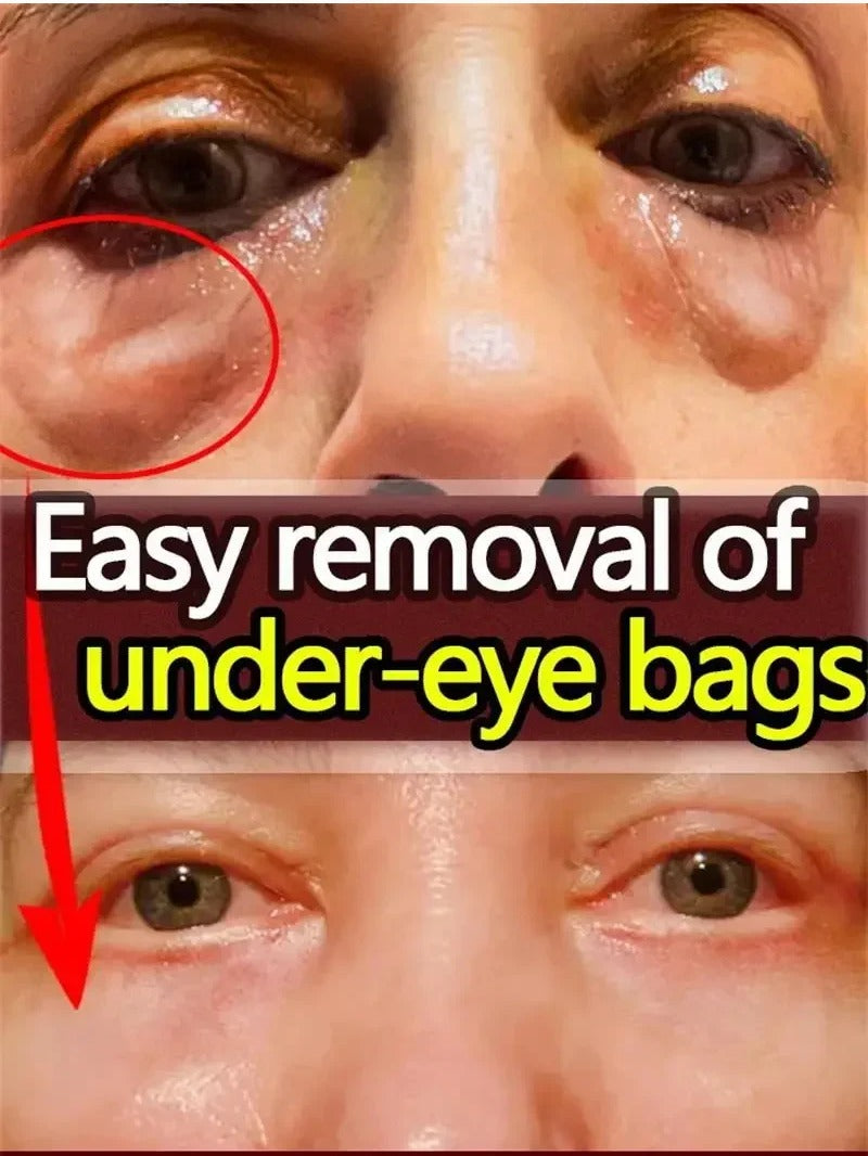 10pcs / 1 Box Eyes Bag Remove Collagen Eye Patch Instant Fade