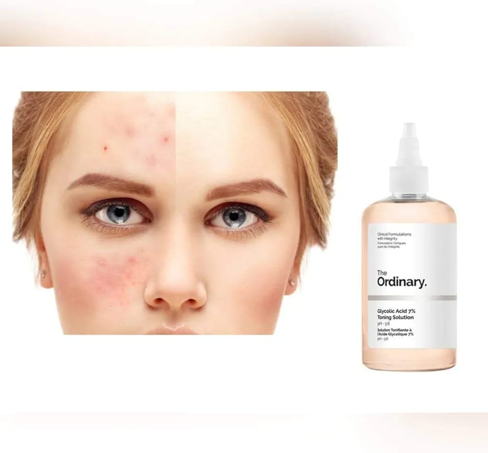 The Ordinary Glycolic Acid 7% Toning Solution Light Weight Liquid Provides Sun