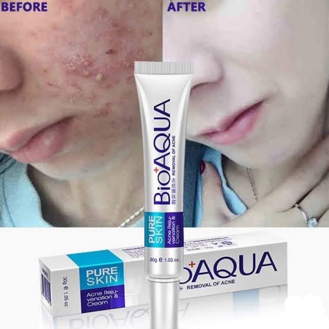 BIOAQUA Anti Acne Cream Acne Scar Removal Cream | Best Quality Scar
