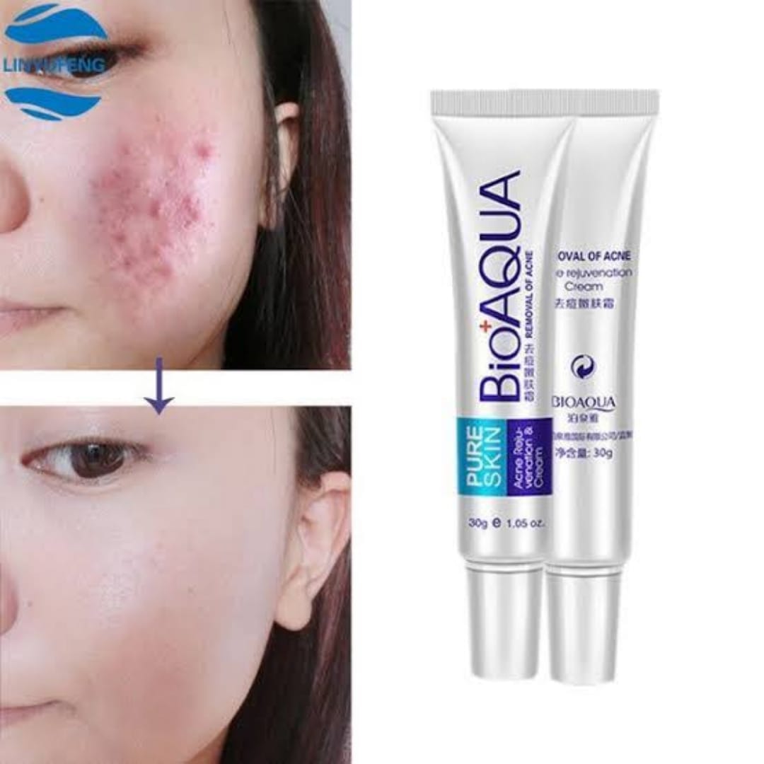 BIOAQUA Anti Acne Cream Acne Scar Removal Cream | Best Quality Scar
