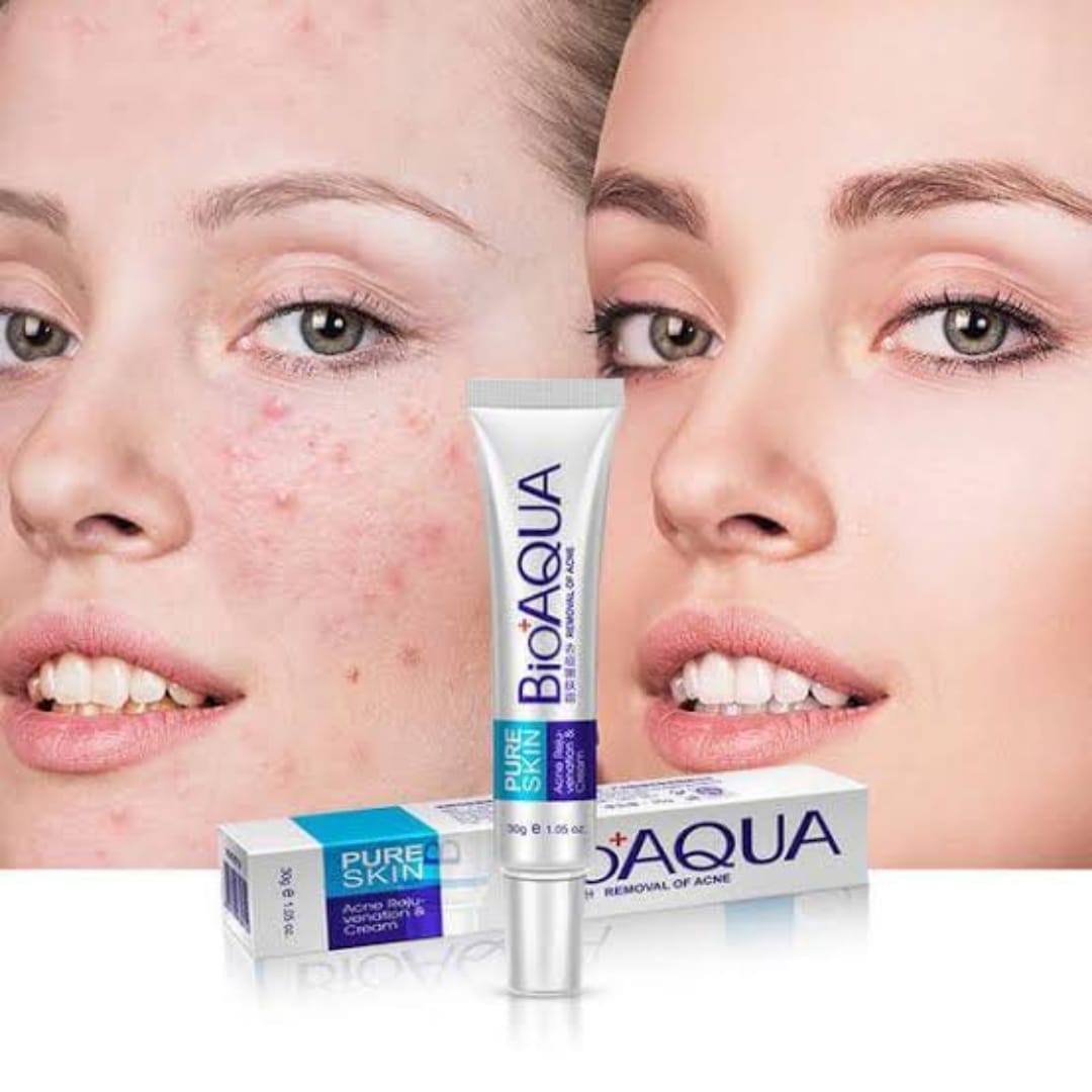 BIOAQUA Anti Acne Cream Acne Scar Removal Cream | Best Quality Scar
