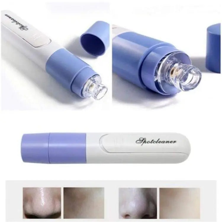 New Electric Blackhead Remover Sucker Black Head Pimple Pore Cleaner Vacuum Blackhead