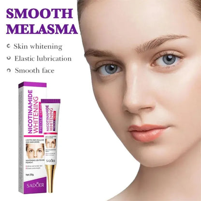 Nicotinamide Whitening Freckles Cream Remove Melasma Dark Spot Acne Marks Lightening Melanin