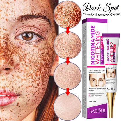 Nicotinamide Whitening Freckles Cream Remove Melasma Dark Spot Acne Marks Lightening Melanin