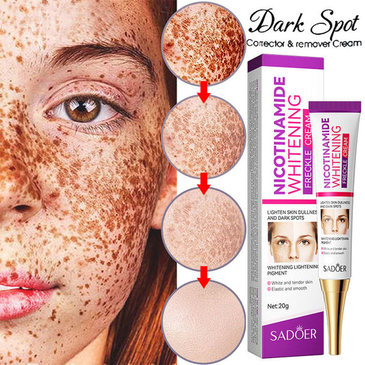 Nicotinamide Whitening Freckles Cream Remove Melasma Dark Spot Acne Marks Lightening Melanin