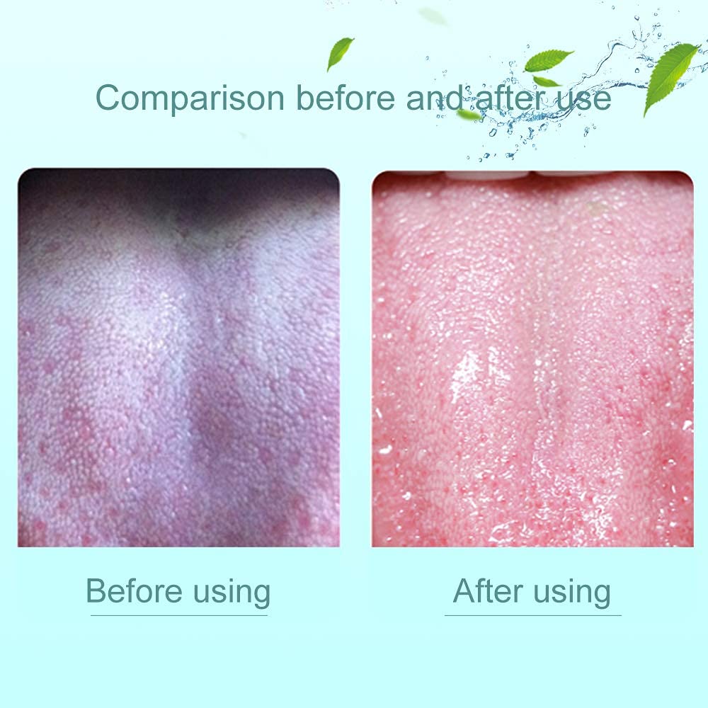 1 Piece Tongue Scraper | Tongue Cleaner | Double Head Tongue Cleaner