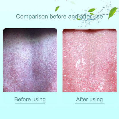 1 Piece Tongue Scraper | Tongue Cleaner | Double Head Tongue Cleaner