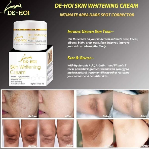 DE HOI Skin Whitening Cream Brightening &amp; Moisturizing Face and Body