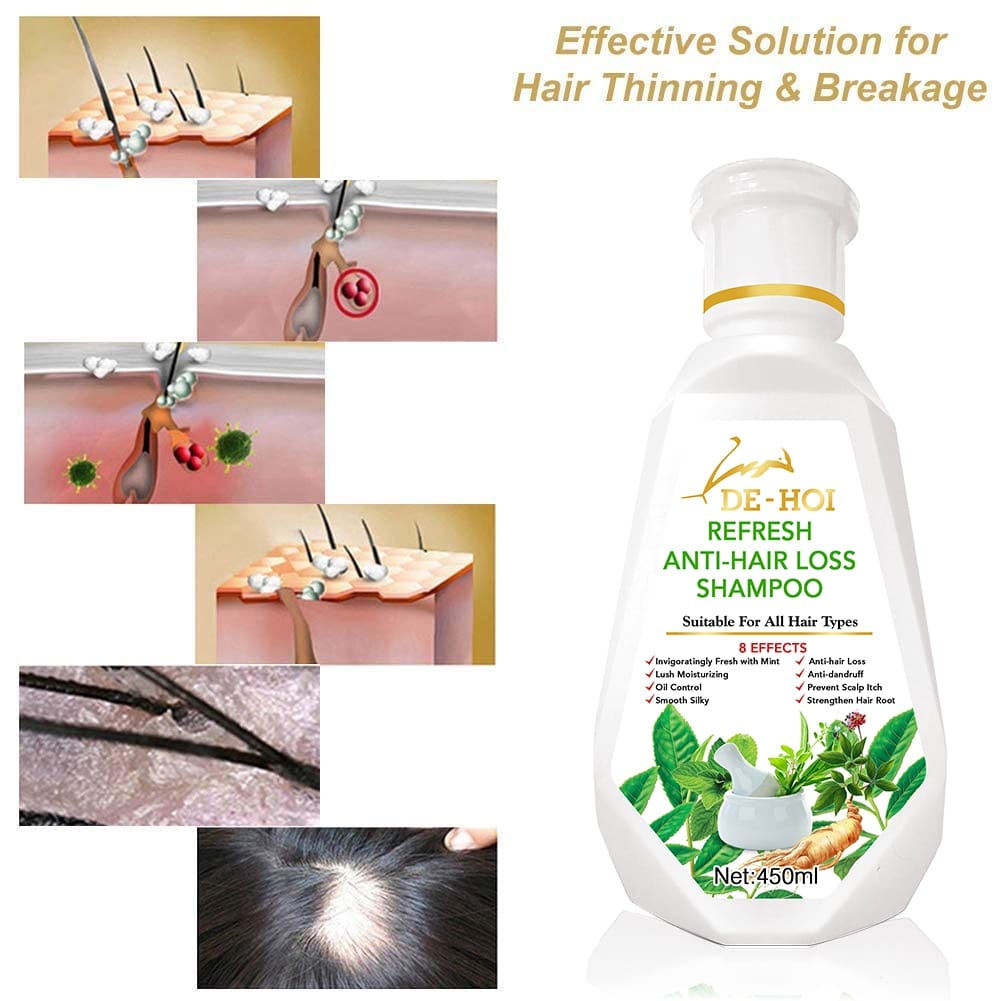 De-Hoi Refresh Anti-hair Loss Shampoo Ginger Hair Care Shampoo Helps Stop