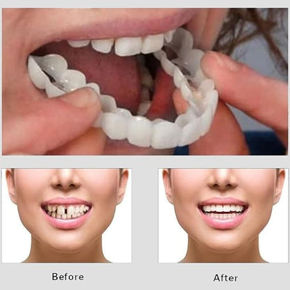 Snap On Smile - Veneers Teeth for Men and Women - Moldable
