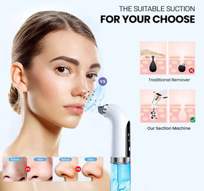 Bubble Facial &amp; Blackhead Remover Deep Cleanser for Acne, Pores &amp;