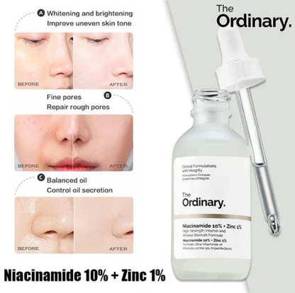 The Ordinary Niacinamide Serum 10% + Zinc 1% Supersize Serum 30ML with