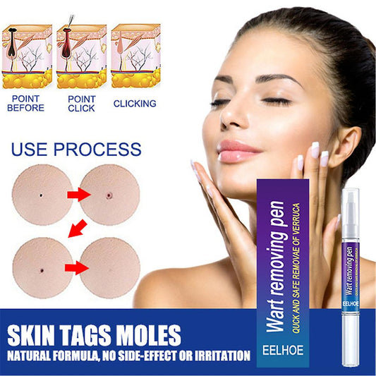 Warts Remover Original Cream Wart Removal Ointment Wart Treatment Skin Tag Mole