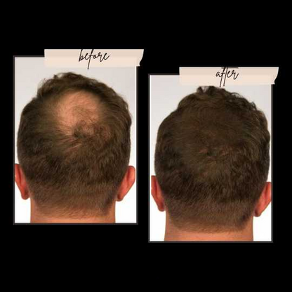 Toppik Hair Building Fiber 3-in-1 Combo Pack. This Set Includes Toppik Hair