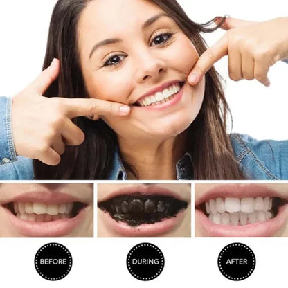 Teeth Whitening Charcoal Powder (Organic) Charcoal (30G)