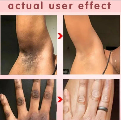 Whitening Cream for sensitive Areas underarm and private Areas - 30g