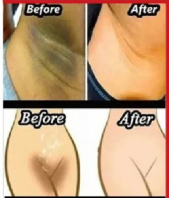 Whitening Cream for sensitive Areas underarm and private Areas - 30g