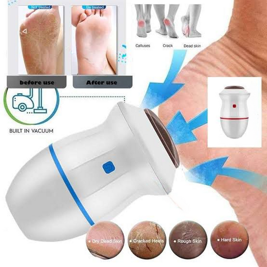 Find Back Electric Foot Vacuum Callus Remover (Cell Operate)
