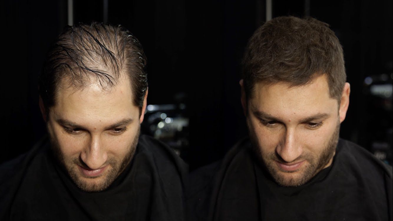 Caboki Hair Building Fibers 25g | Black | Dark Brown Hair