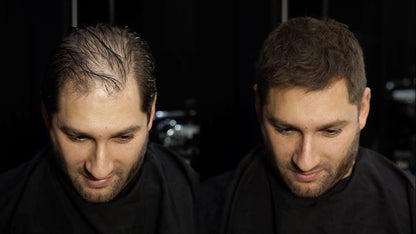 Caboki Hair Building Fibers 25g | Black | Dark Brown Hair