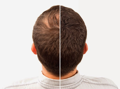 Caboki Hair Building Fibers 25g | Black | Dark Brown Hair