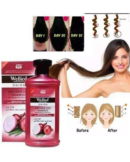 "Wellice Onion Anti Hair Loss Shampoo - Strengthening &amp; Nourishing Formula for