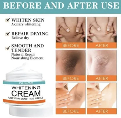 Sensitive Area Whitening Cream for Private Parts, Underarms, Inner Thighs, and Dark