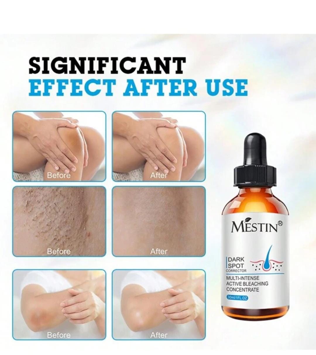 MESTIN Anti-Sun Spot Essence 30ml - Corrects Hyperpigmentation, Fades Dark Spots, Evens