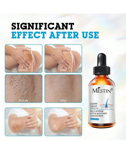 MESTIN Anti-Sun Spot Essence 30ml - Corrects Hyperpigmentation, Fades Dark Spots, Evens