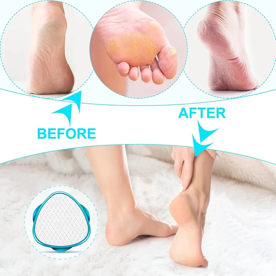 2 in 1 Double-Sided Nano Glass Callus Remover &amp; Crystal Hair Eraser - CheckNpays