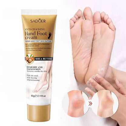 SADOER Hand Foot Cream - 60gram Hand Foot Cream Moisturizing Calluses Dead