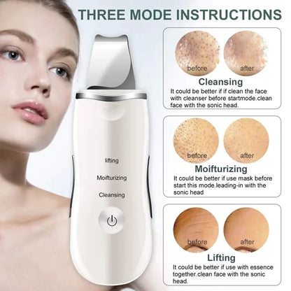 Rechargeable Ultrasonic Skin Scrubber Deep Cleansing Facial Spatula &amp; Blackhead Remover